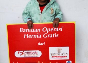 TeMPO SCAN Gelar Operasi Gratis ‘Bibir Sumbing’ di RSUD Ruteng