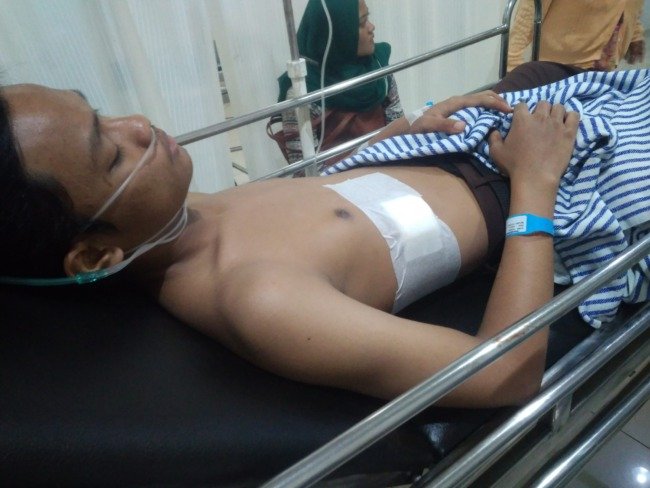 Dicegat di Tengah Jalan, Satu Pelajar SMP Kena Sabetan Celurit