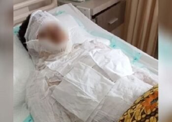 Samsudin, Suami Yang Dibakar Istri Dirawat di Ruang ICU RSU Fatmawati