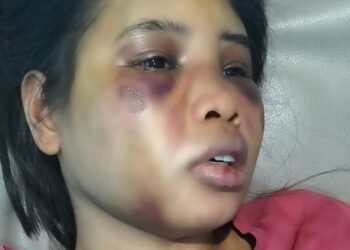 Polisi Tangkap Satu Orang Terduga Pelaku Penganiayaan Brutal Terhadap Intan,  ART asal Sumba di Batam